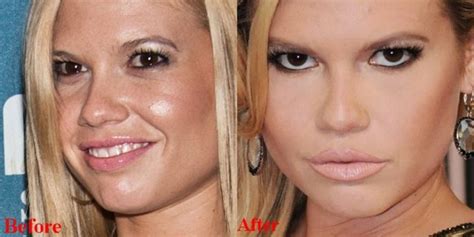 chanel west coast fakes|Free Chanel West Coast Fakes Photos .